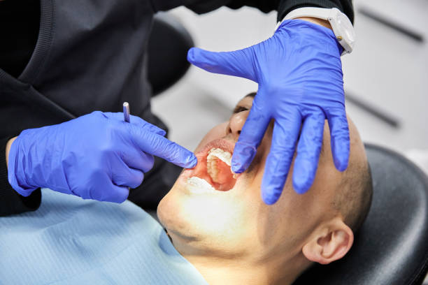 Best Broken or Chipped Tooth Repair in Woburn, MA