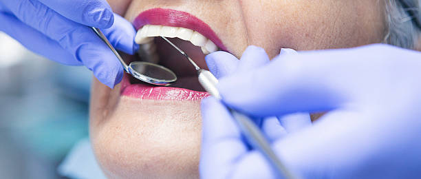 Best Knocked-Out Tooth (Avulsed Tooth) Treatment in Woburn, MA